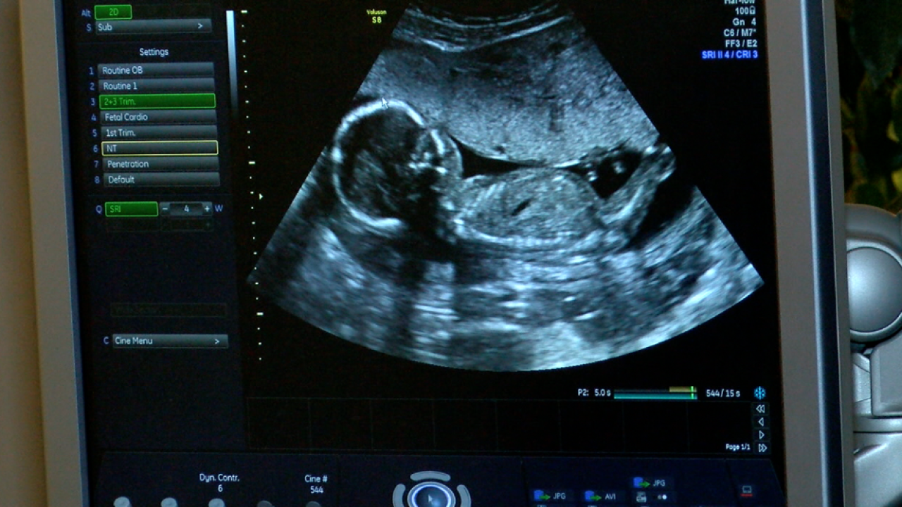 Boy Or Girl The Earliest Gender Reveal Available In Western New York