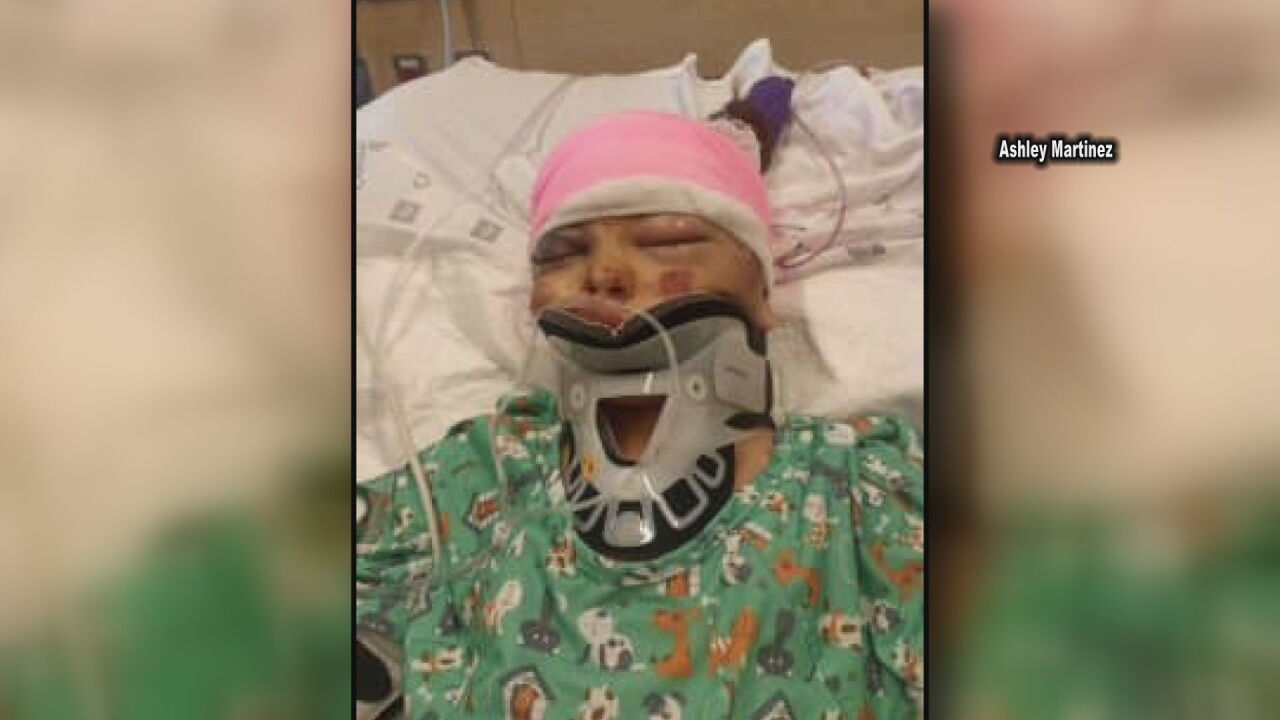 Pueblo girl seriously injured after being hit by vehicle in neighborhood