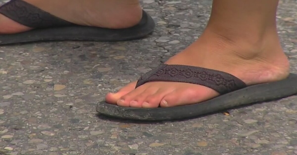 Doctors warn about the dangers of flipflops