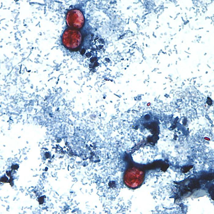 cyclospora.jpg