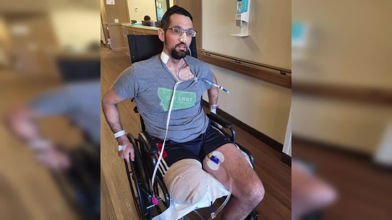 Walker post amputation