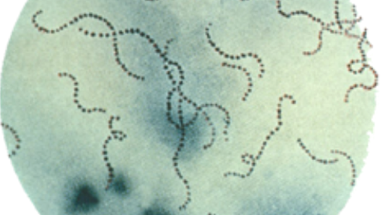 Flesh Eating Bacteria Florida Map Maps For You