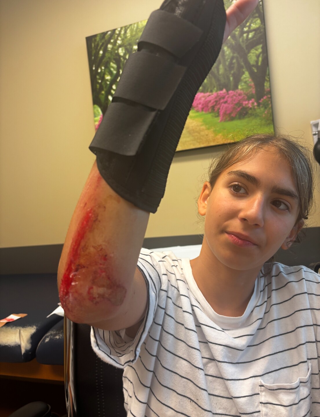 Sunnye injuries