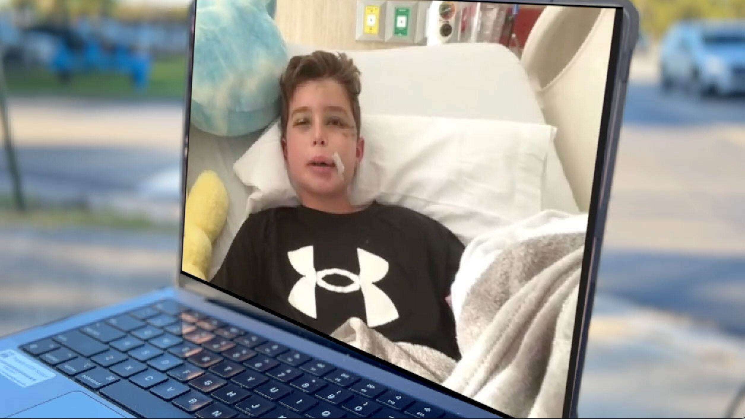 Jupiter boy hospitalized after electric bike crash