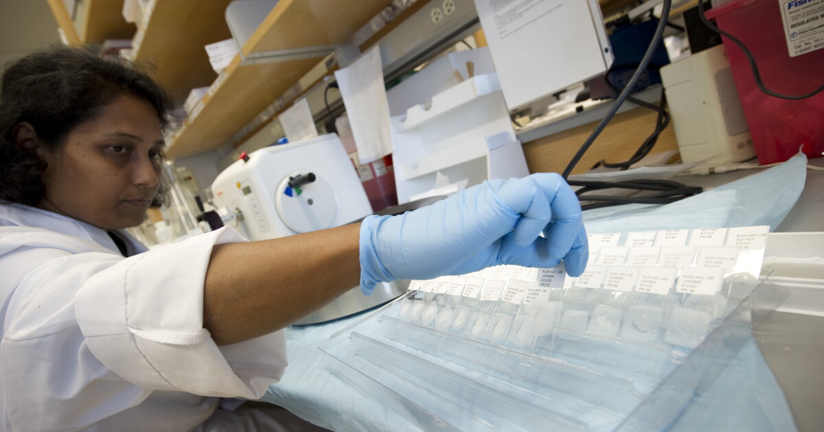 Bebler Lab Testing New blood testing and therapies show promise in Alzheimer's treatment