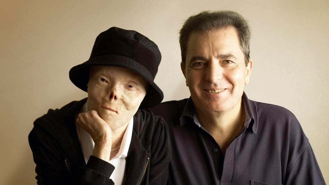 'Face of Drunk Driving' Jacqui Saburido dies after battle with cancer