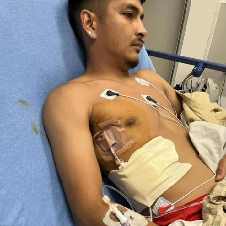 Carlos Torres' collapsed lung