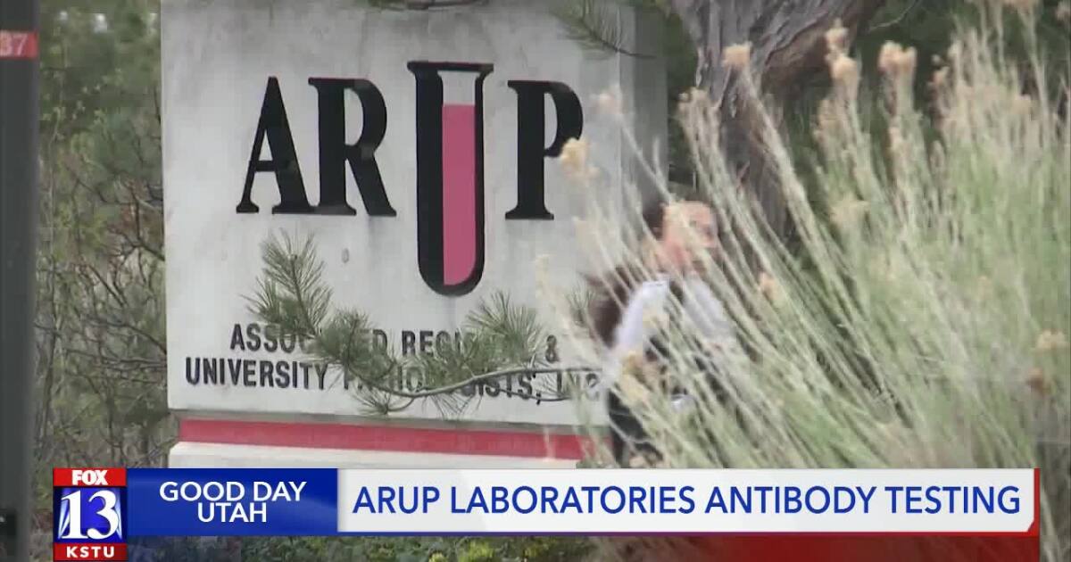 Utah Based Arup Launches Nationwide Covid 19 Antibody Testing
