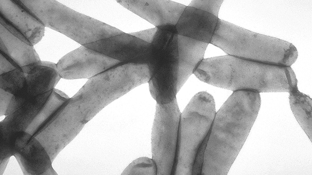 Michigan Hospital Investigating Possible Legionnaires