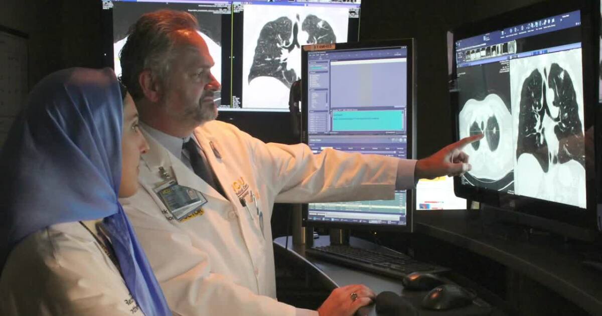 Lung cancer screenings save lives