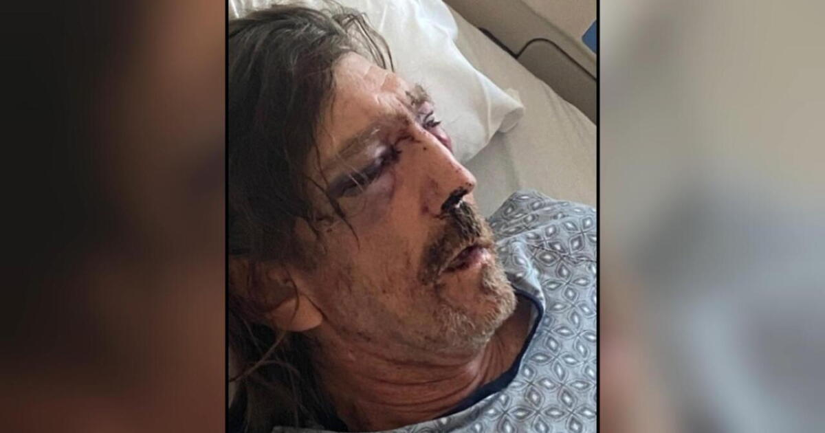 Deputies face federal charges for excessive use of force, lying to investigators - Vimarsana News