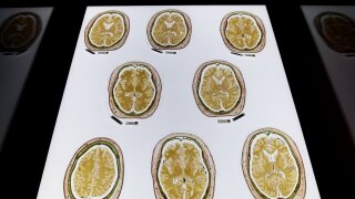 Brain scans