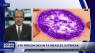 Pennsylvania reports 2 more measles deaths as outbreak worsens