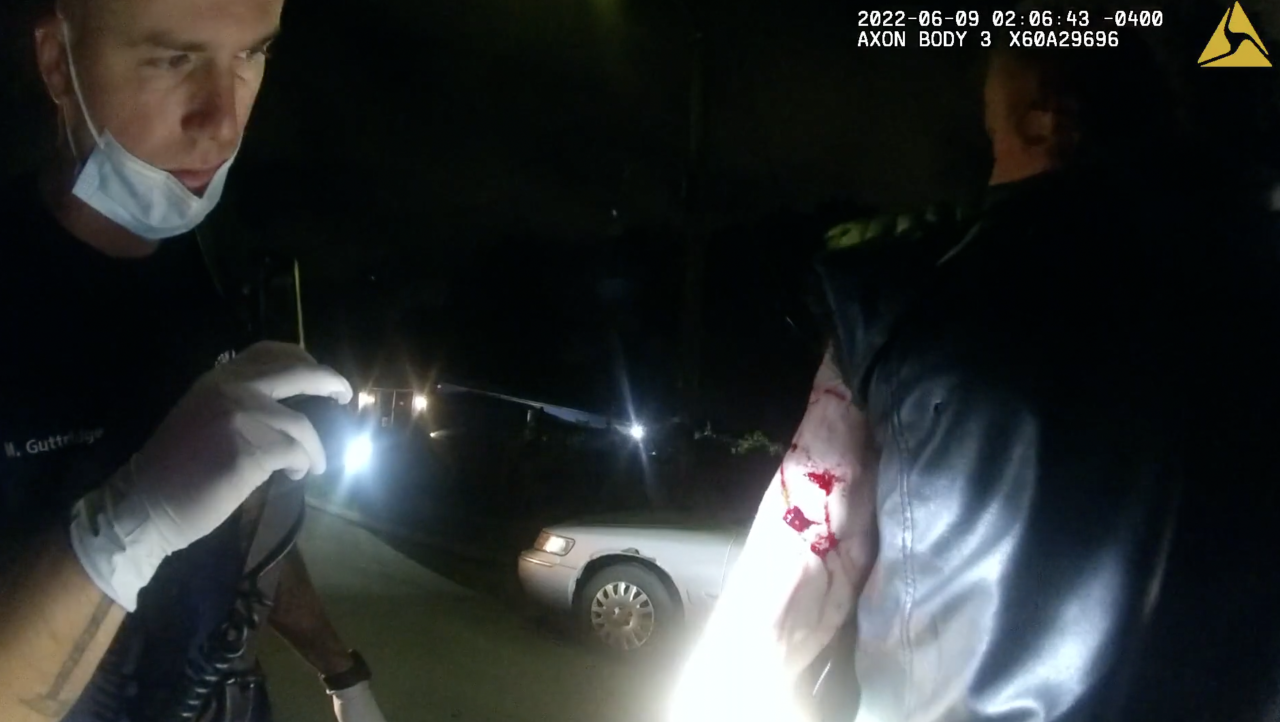 A Covington firefighter examines Sean Davis' injuries caused by a police dog biting him in June 2022