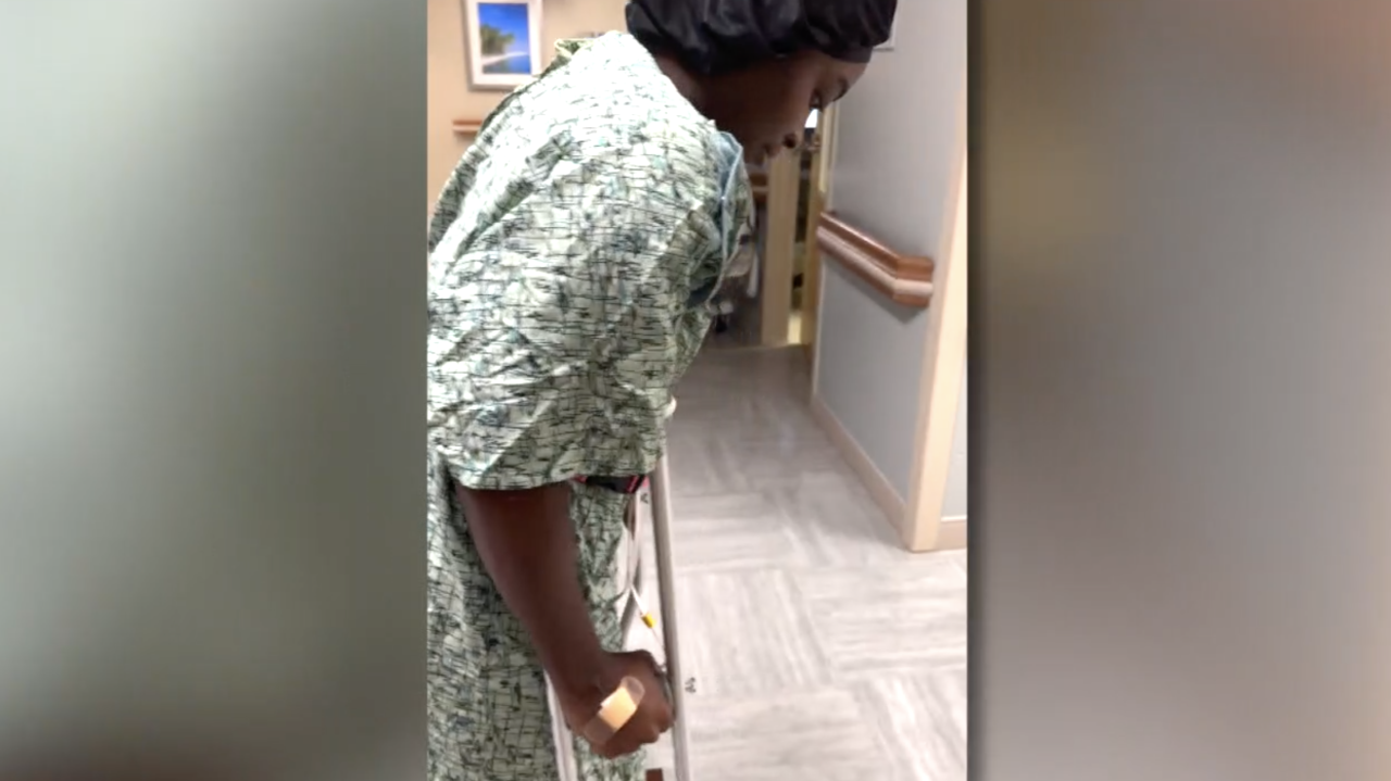 Monet Robinson hospitalized after rattlesnake bite 11292023