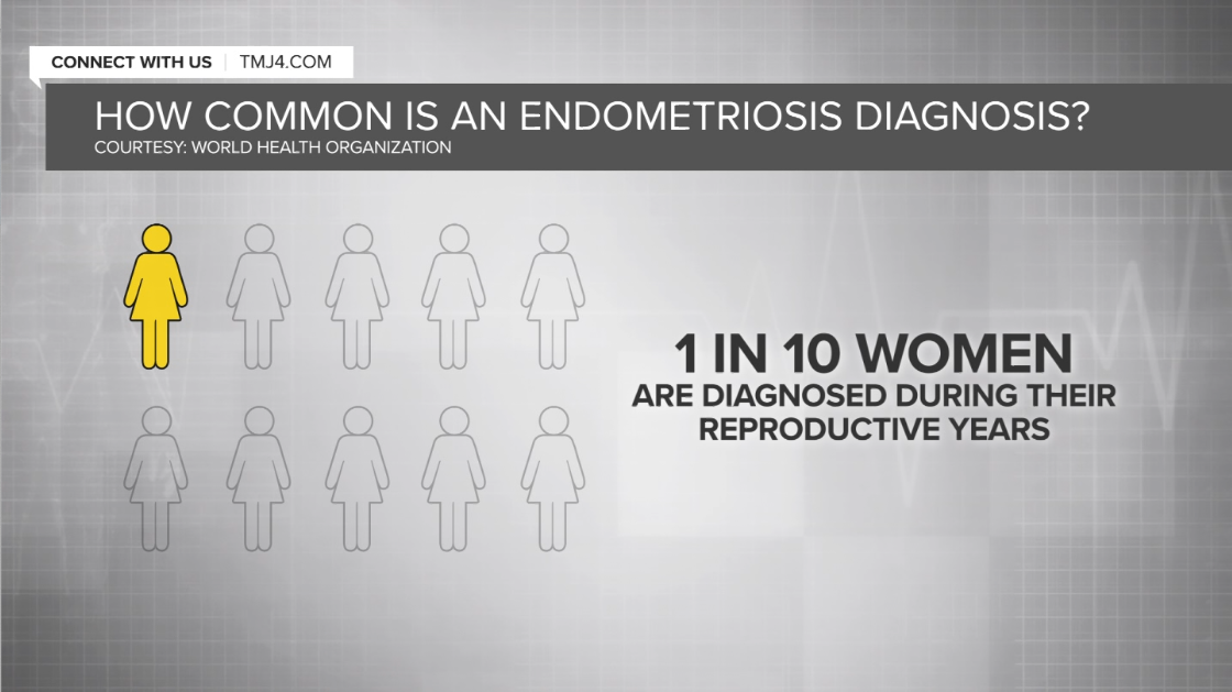 Endometriosis Diagnosis