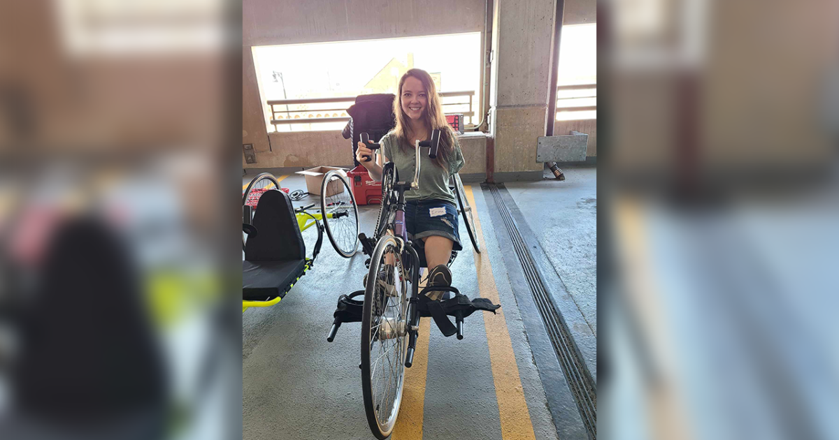 3D printed prosthetic helps show young woman's zest for life - Vimarsana News