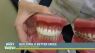 Building a better smile