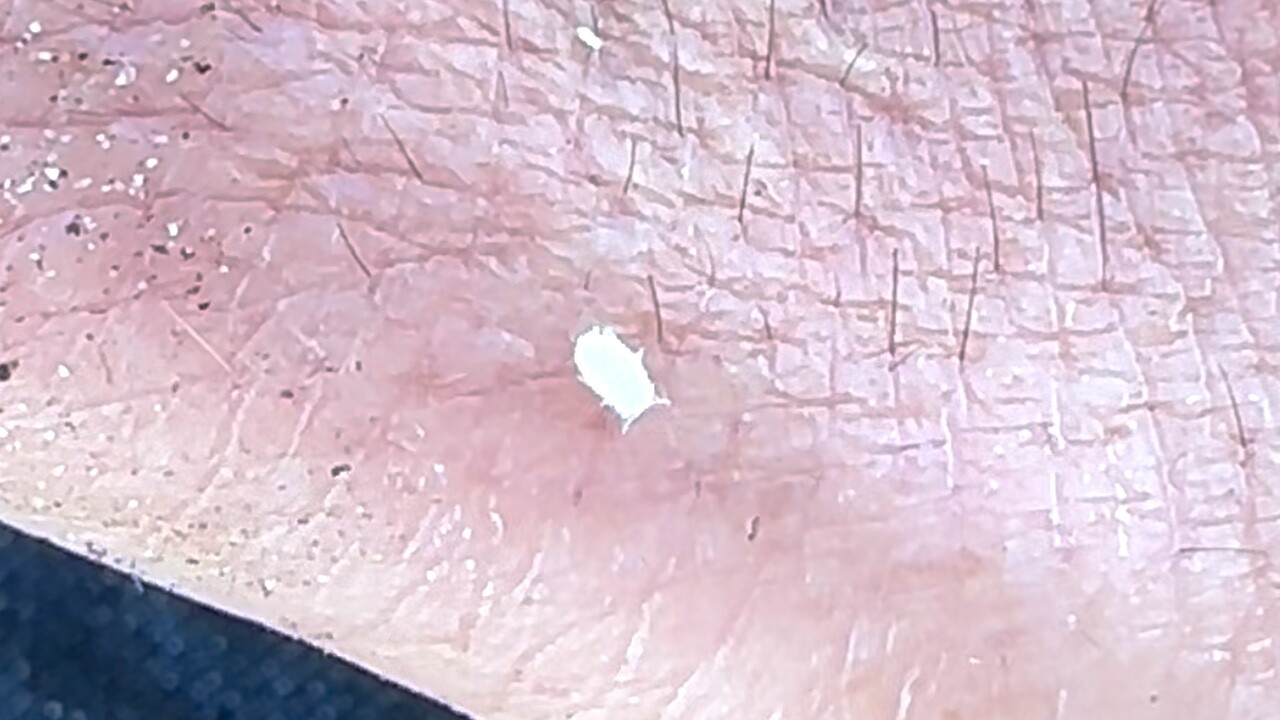 Pasture Mealybug.jpg
