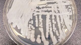 A culture of Candida auris.