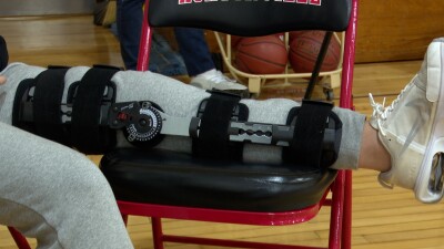 Beyond the Score: Female athletes more prone to ACL injuries, but why?