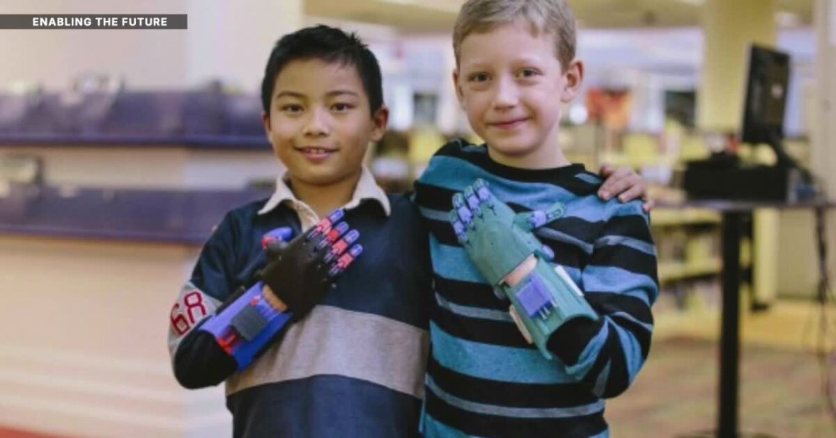 Arizona State University student gaining global recognition for app to help prosthetics users