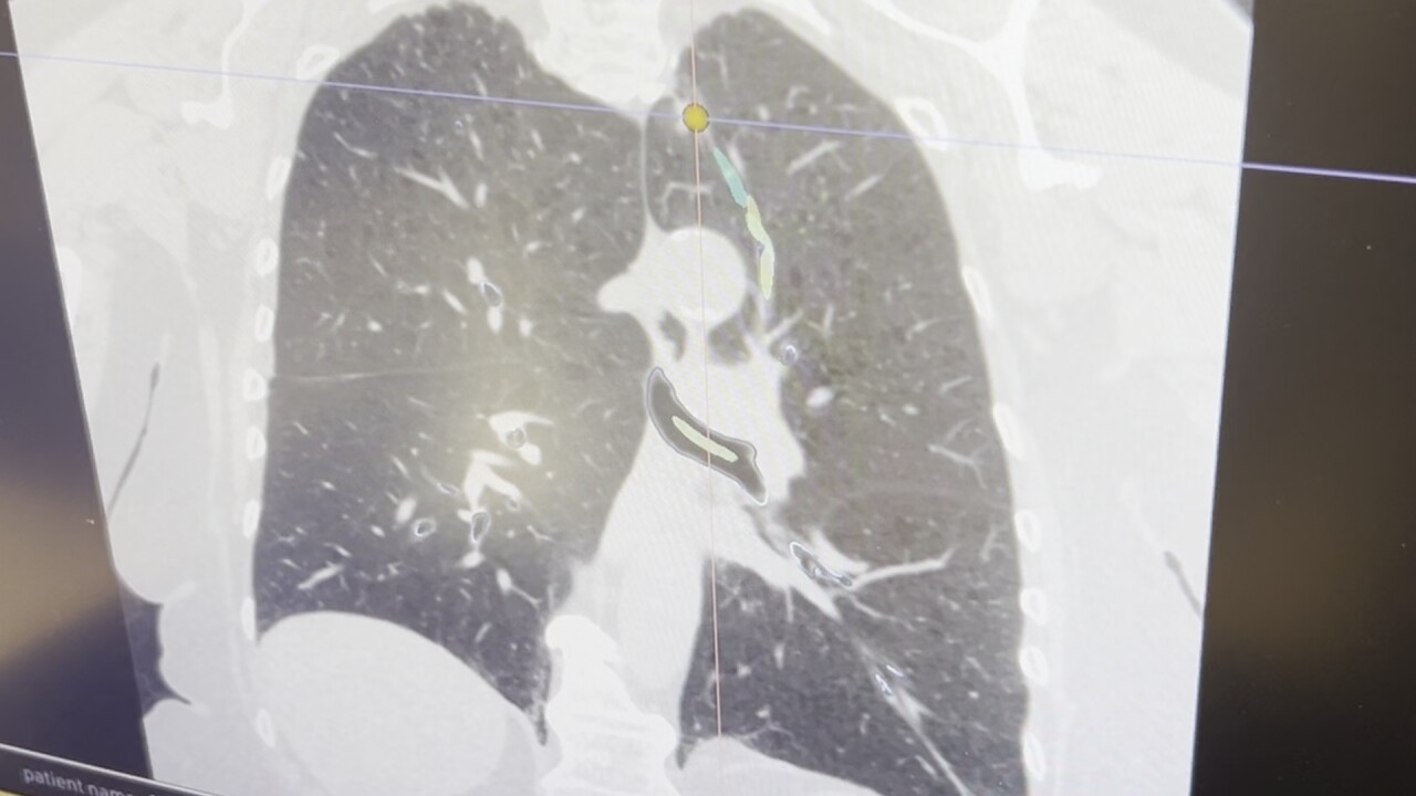 lung cancer web 2_2.3.1.jpg