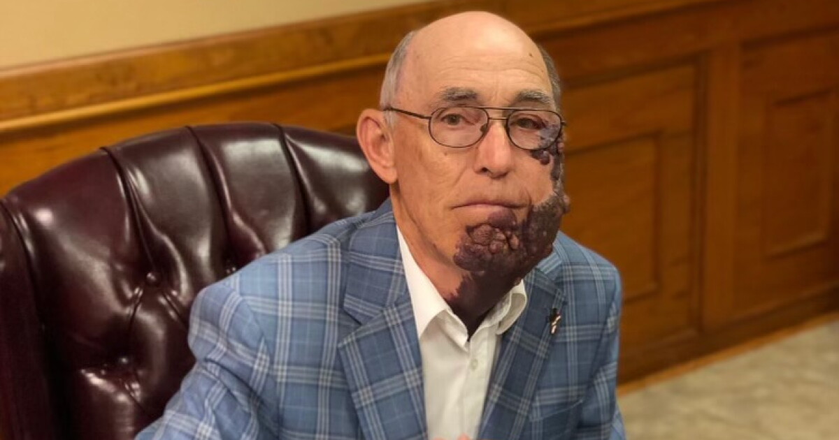 Longest serving councilman in Church Point dies at age 76