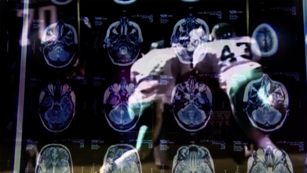 football-concussion.png