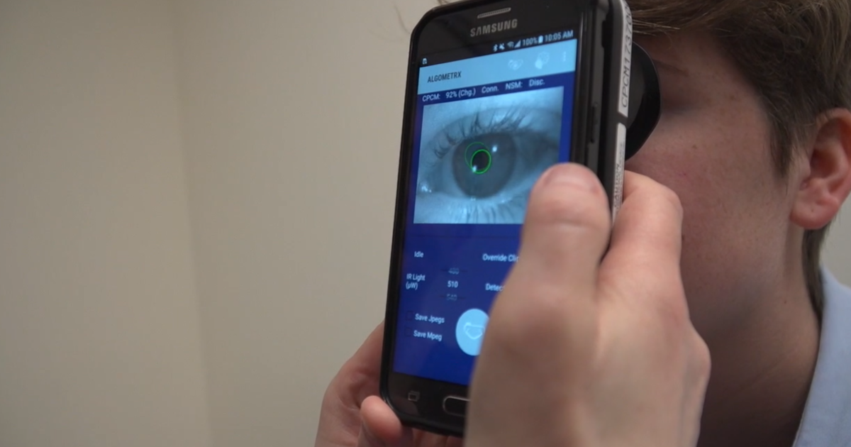 Doctor creates device to measure pain in patients