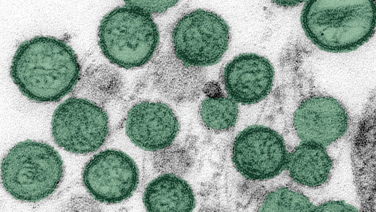 hantavirus.png