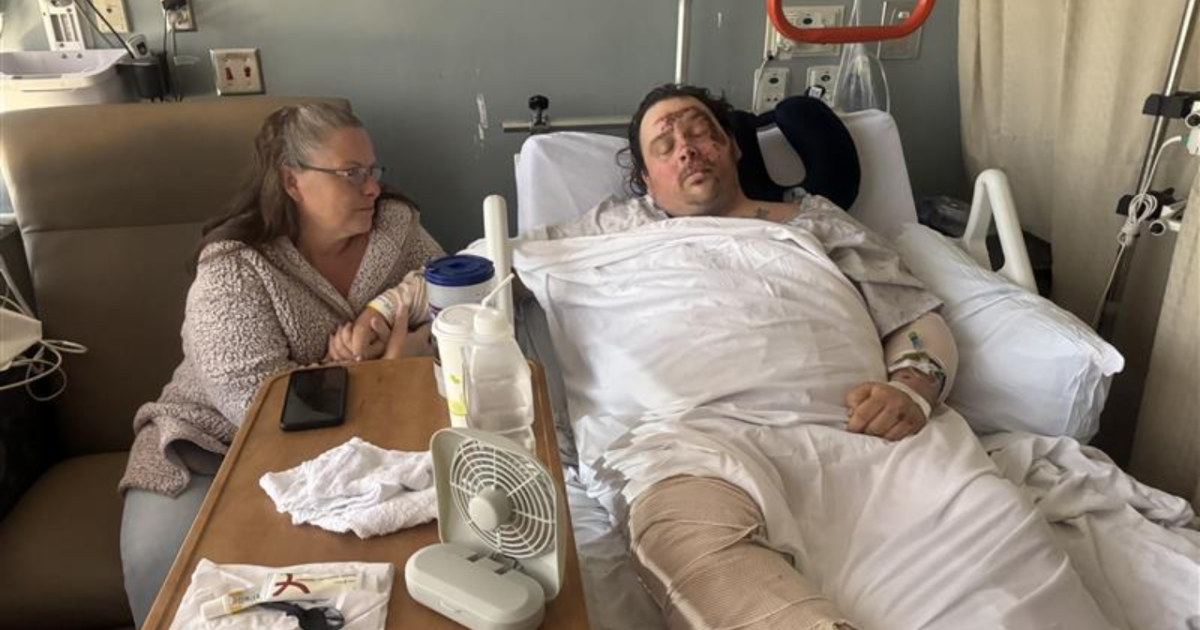 Hit-and-run victim pushes for motorcycle safety from hospital bed