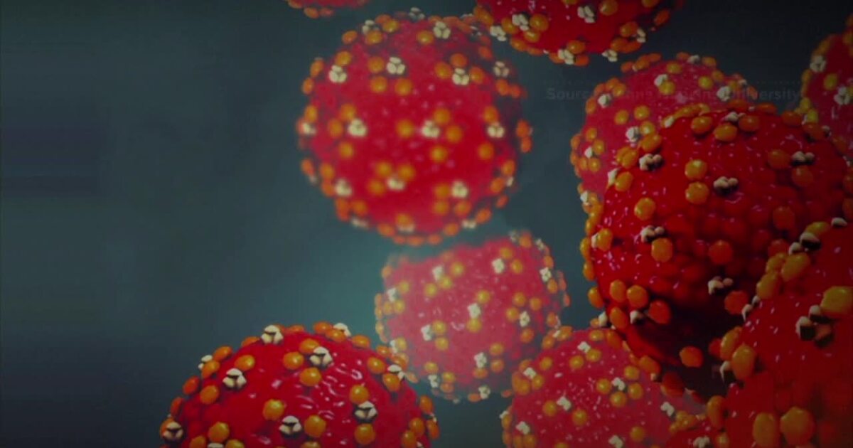 Idaho measles cases climb as families prepare for back-to-school