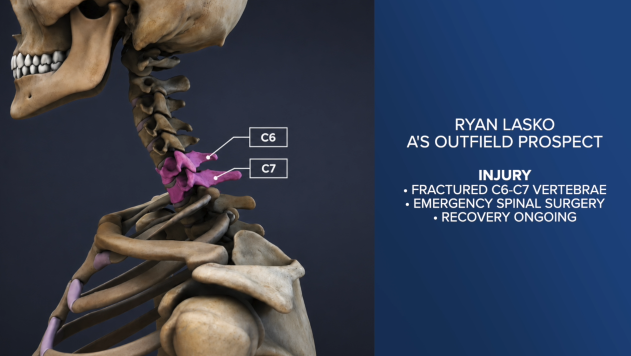 Former Las Vegas Aviator Ryan Lasko receives organization-wide support after devastating spinal injury