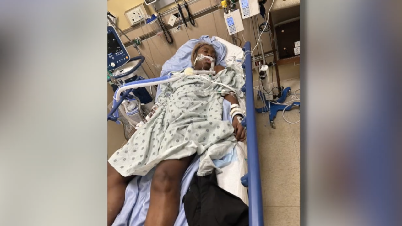 Monet Robinson hospitalized after snake bite 11292023