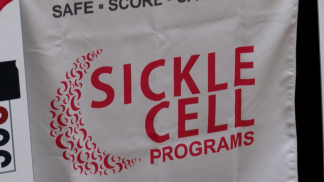 Sickle Cell Disease 3.png