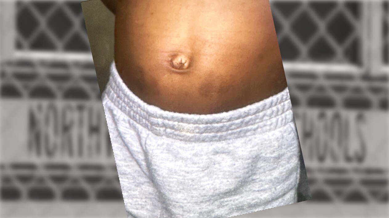 web abdomen photo.jpeg