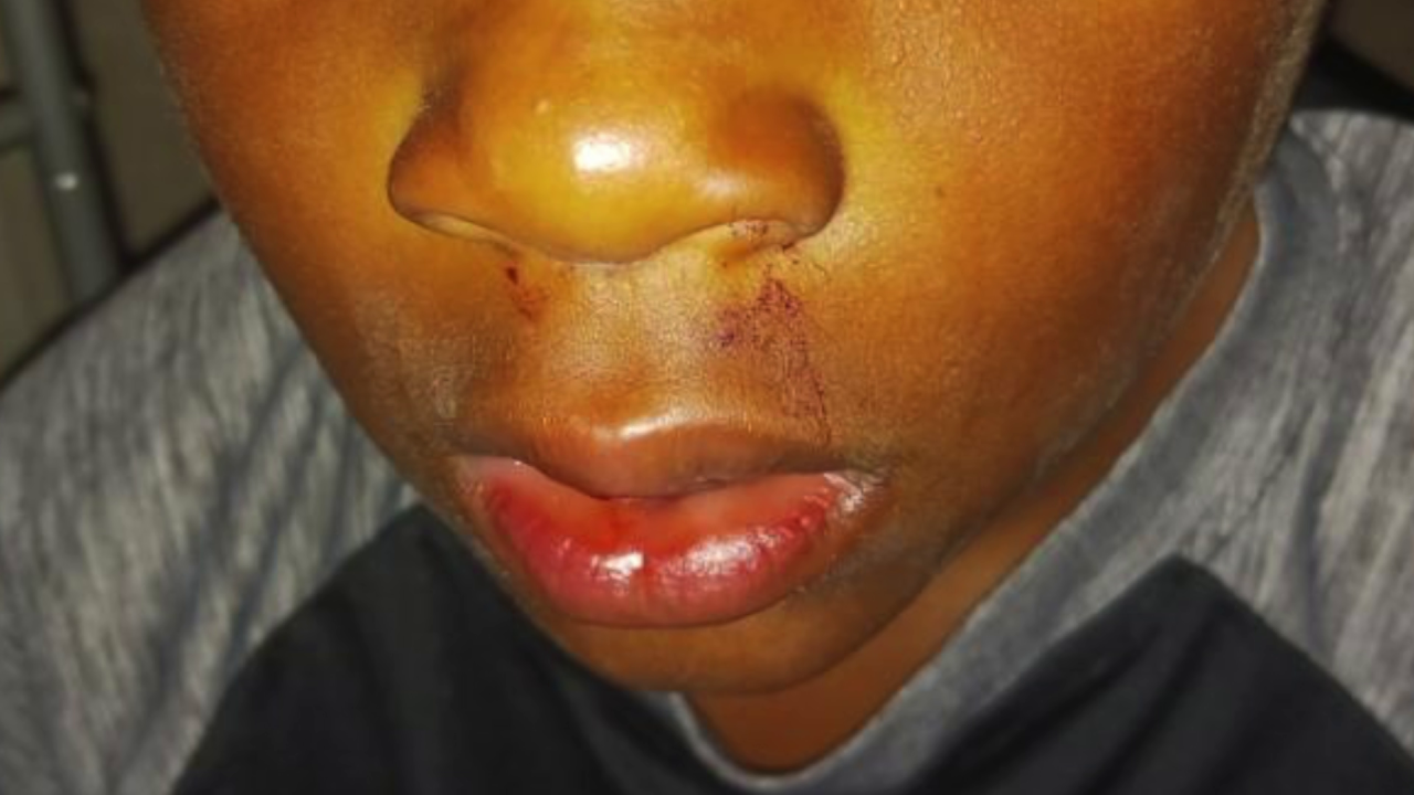 Boy bullied at Newport News school