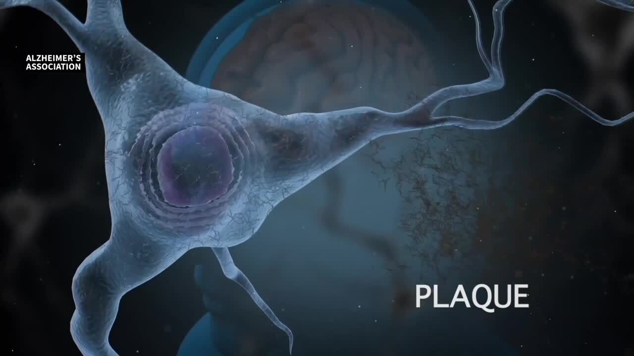 Finding new ways to fight Alzheimer's