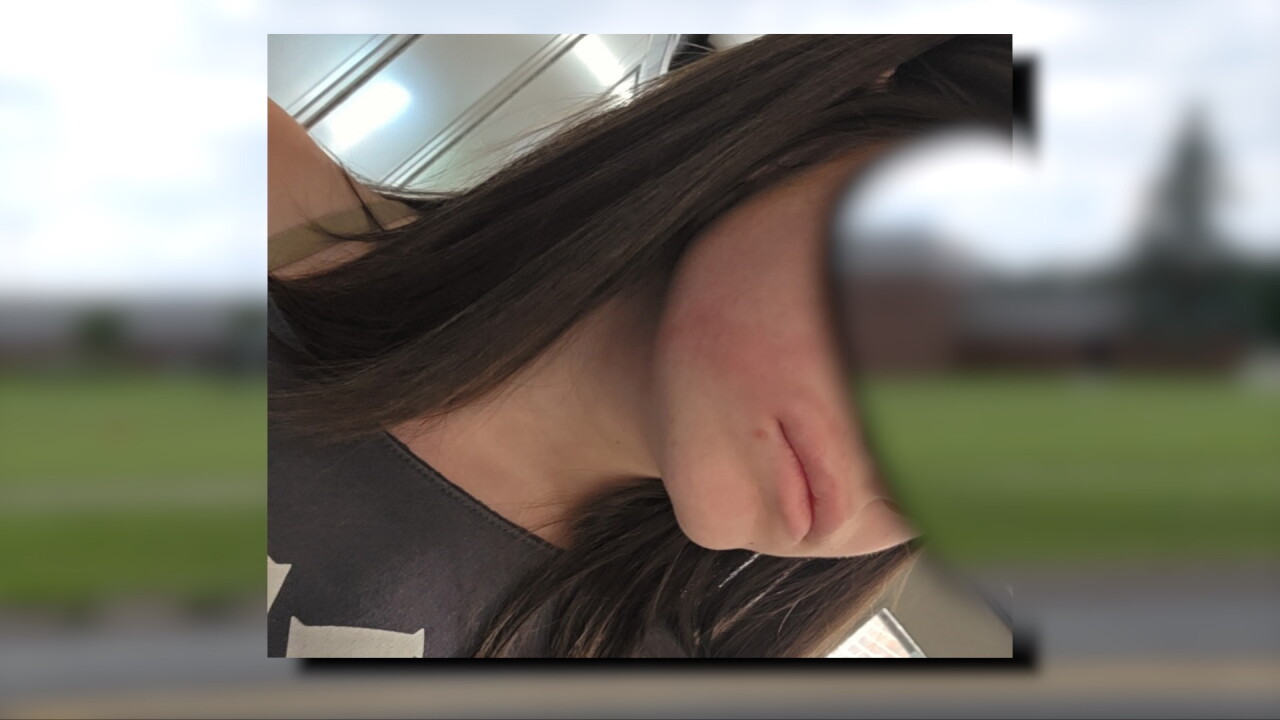 alleged assault picture.jpg