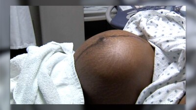 Black women face highest risk of pregnancy complications, expert explains