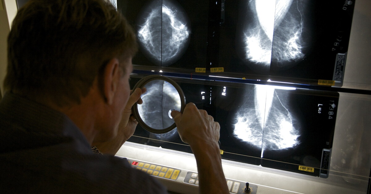 Phoenix Raceway hosting FREE mobile mammogram screenings Thursday - Vimarsana News