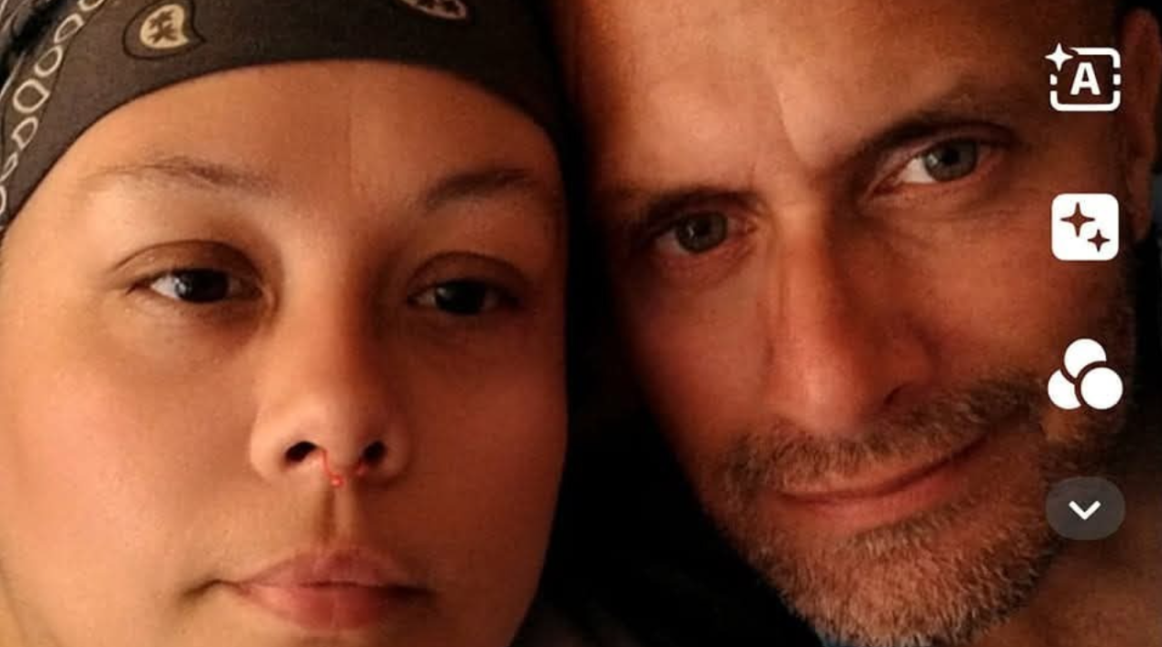 On Friday, he underwent a skin graft surgery expected to last 90 minutes at Tampa General Hospital.
