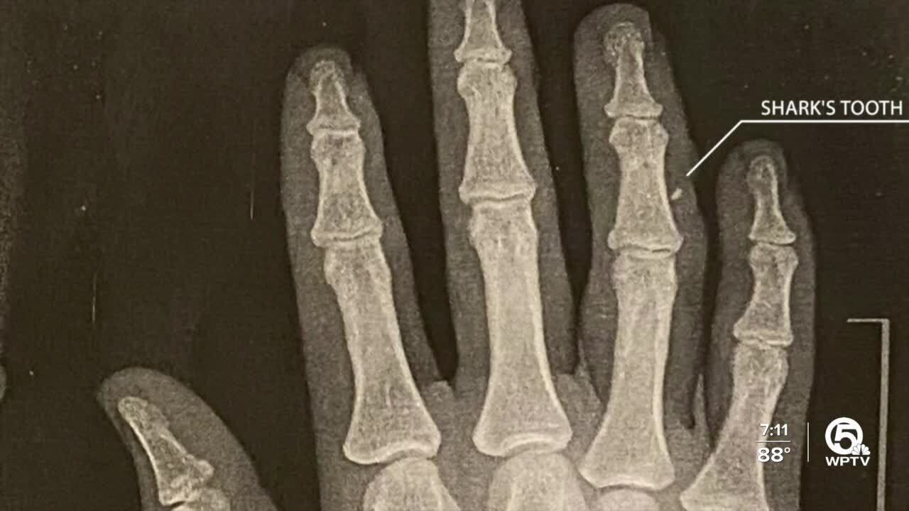 shark's tooth still in Sophia Scroggie's right hand