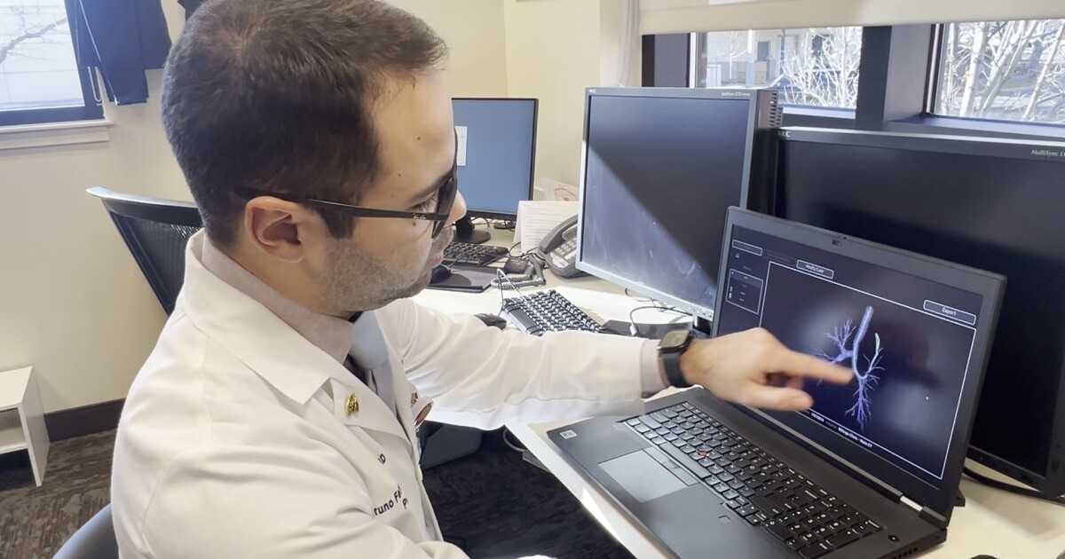 Montana doctor says early detection key to preventing lung-cancer deaths