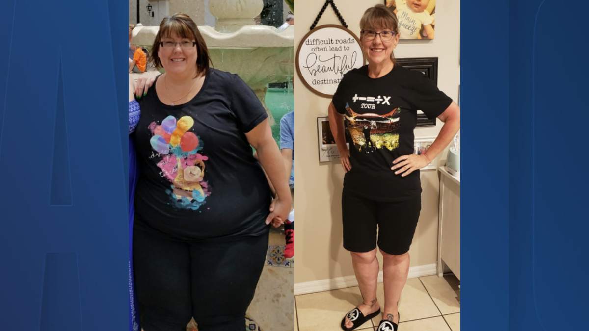 tirzepatide weight loss st petersburg Local woman shares weight loss journey after shedding 182 pounds using  Mounjaro