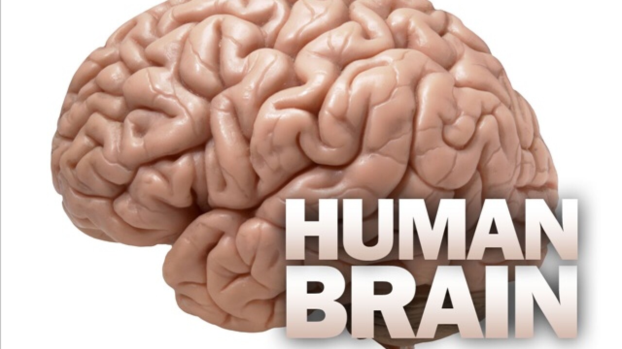 Official: Obama to announce brain mapping project