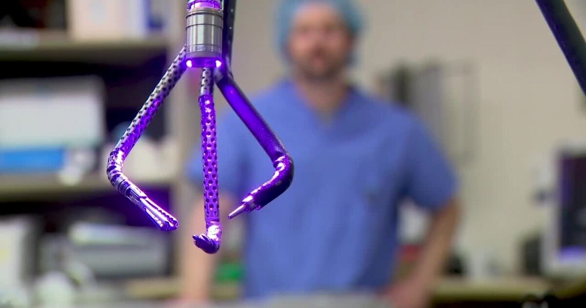 Medical robot performs almost a dozen head, neck surgeries in Utah Medical robot performs almost a dozen head, neck surgeries in Utah