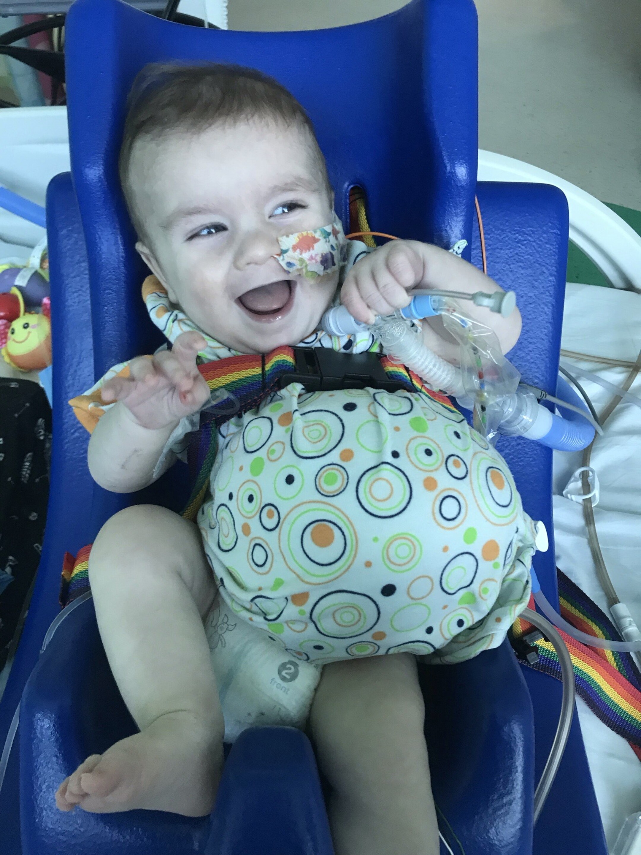 Toddler born with organs outside his body continues to push boundaries