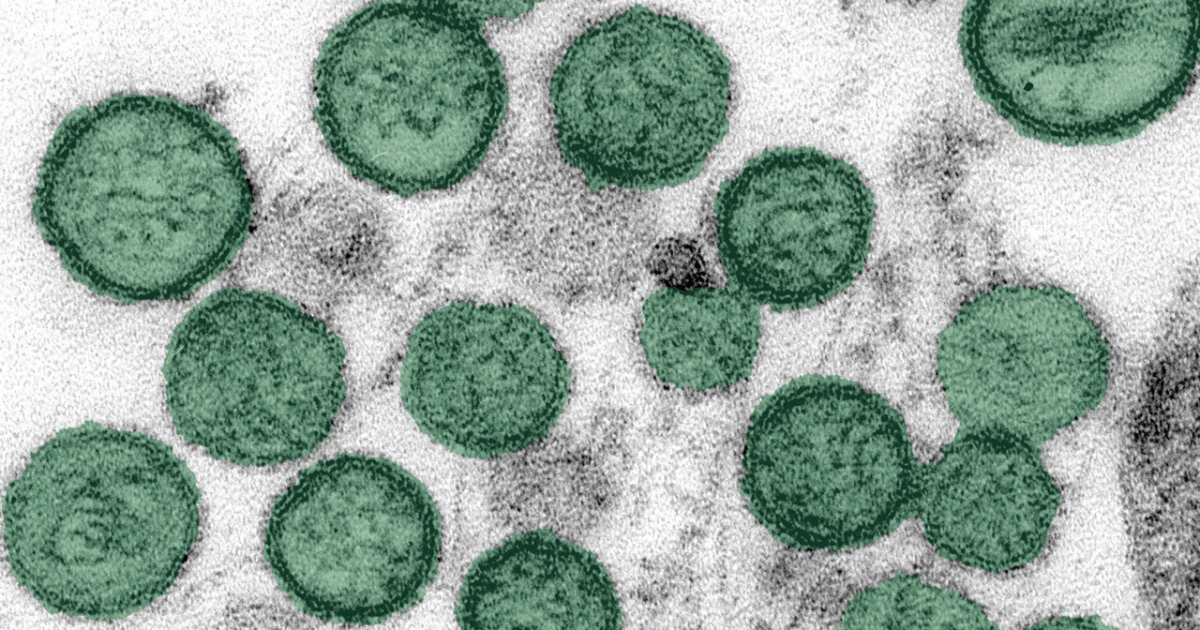 Douglas County adult dies from hantavirus; case not linked to cruise ship outbreak - Denver7